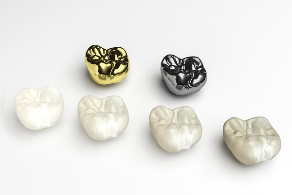 Dental Crowns To Protect Your Tooth