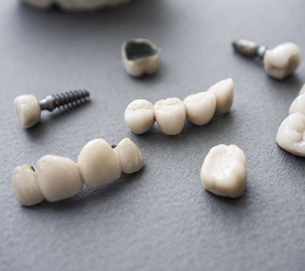 New Rochelle The Difference Between Dental Implants and Mini Dental Implants